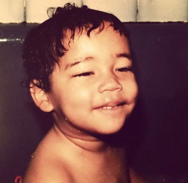 InsDaily 他被嘲“整形怪”10年！如今自曝毁容烧伤照，网友：又来炒作！