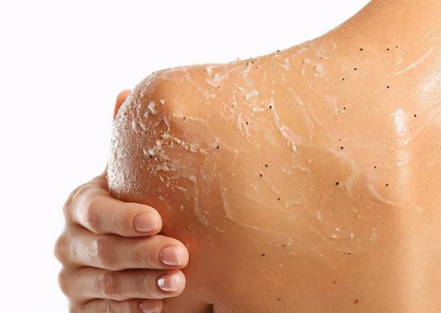 魔力|太苦了太苦了，背后长痘的女生都太苦了