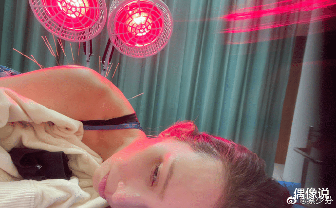 蔡少芬|三胎妈妈蔡少芬晒病床针灸照，画面揪心，感慨：当妈妈不容易