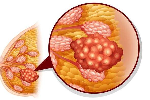 医说健康|预防癌症发生，多留意身体这6个部位，发现异常后，及时就医