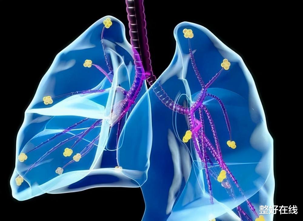 湿疹|50岁后经常气短、胸闷、体力不支？或是患了肺大疱，该如何养肺？