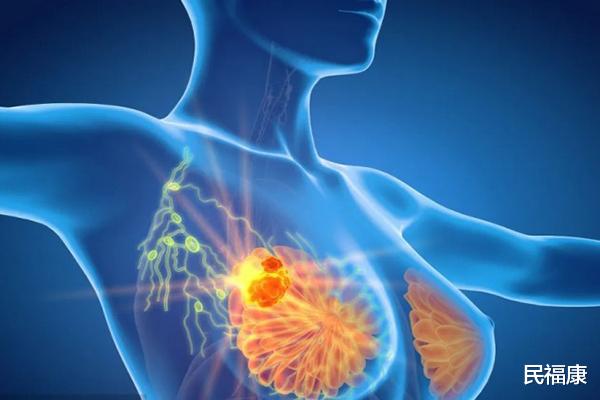 绝经|女性50岁后,还没有绝经,是不是好事?如何在更年期抗老?