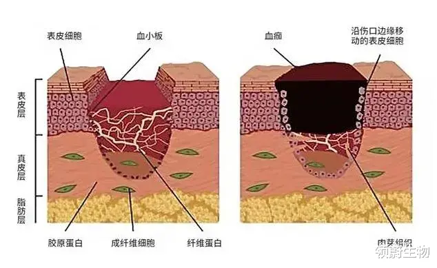 领蔚生物 脐带间充质干细胞是如何促进烧伤皮肤修复愈合的？