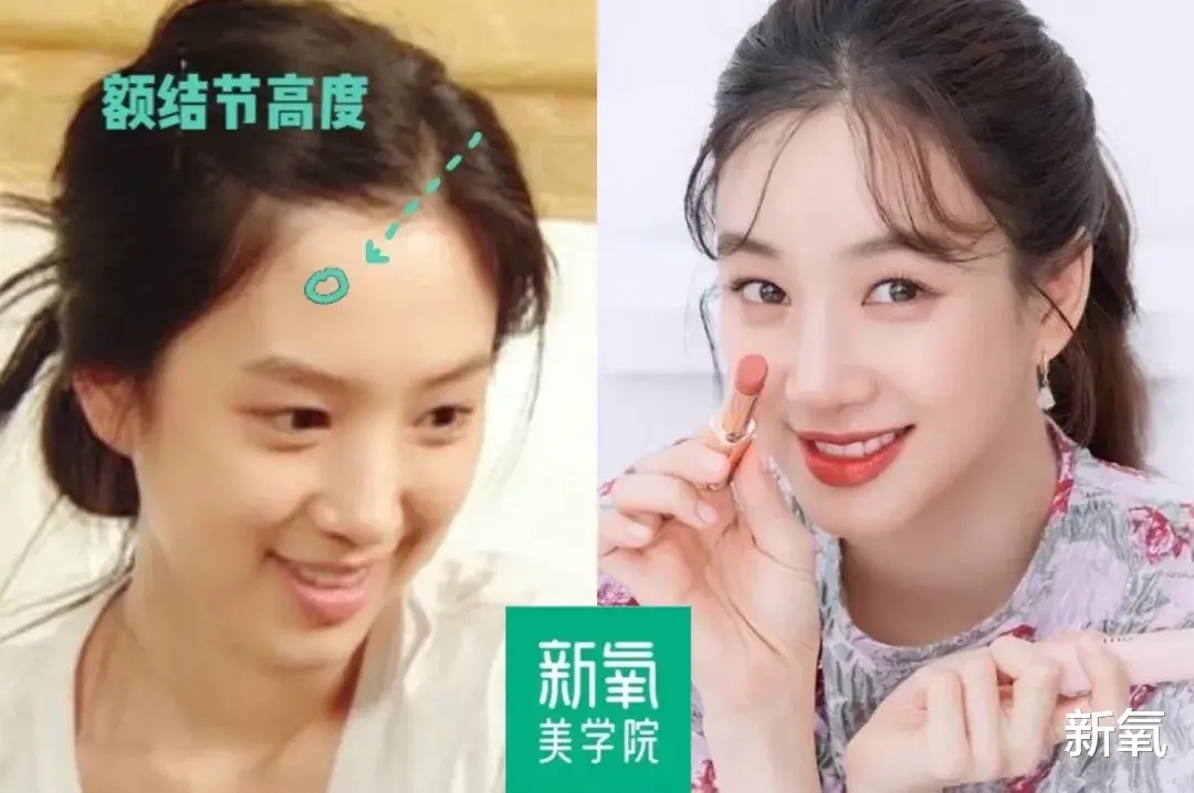 发际线 每个人造美女，都畏惧这种地狱级变美难度的骨相