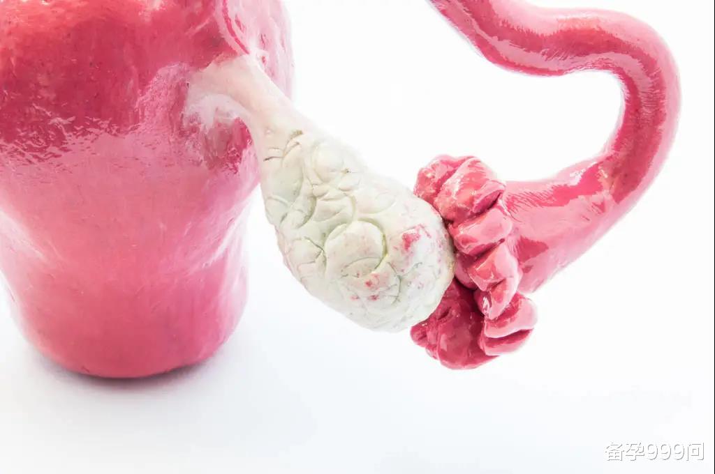 备孕999问|巧克力囊肿竟要手术治疗！术后会影响怀孕吗？