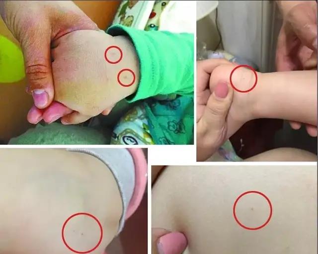 吴洪娜聊说育儿|又曝幼儿园幼儿被扎针事件!不良幼师为何偏爱用针为“武器”?