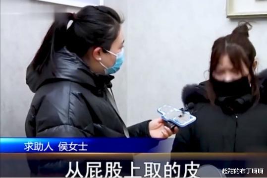 臀部|臀部割皮给眼睛做卧蚕，没想到翻车来得太快，男友：你眼睛丑死了