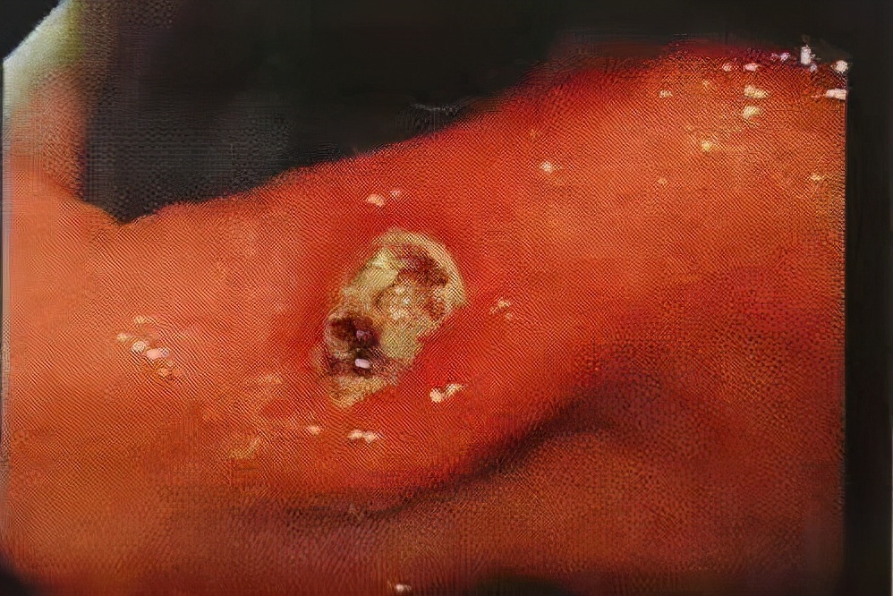 熊猫医学社|吃一次等于10瓶牛奶！消化科主任：若你爱吃，清幽养胃胃舒坦