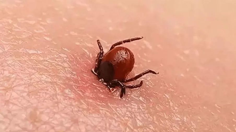 心血管疾病|警惕身上长的这些小红点，可能是身体亮出的“红灯”