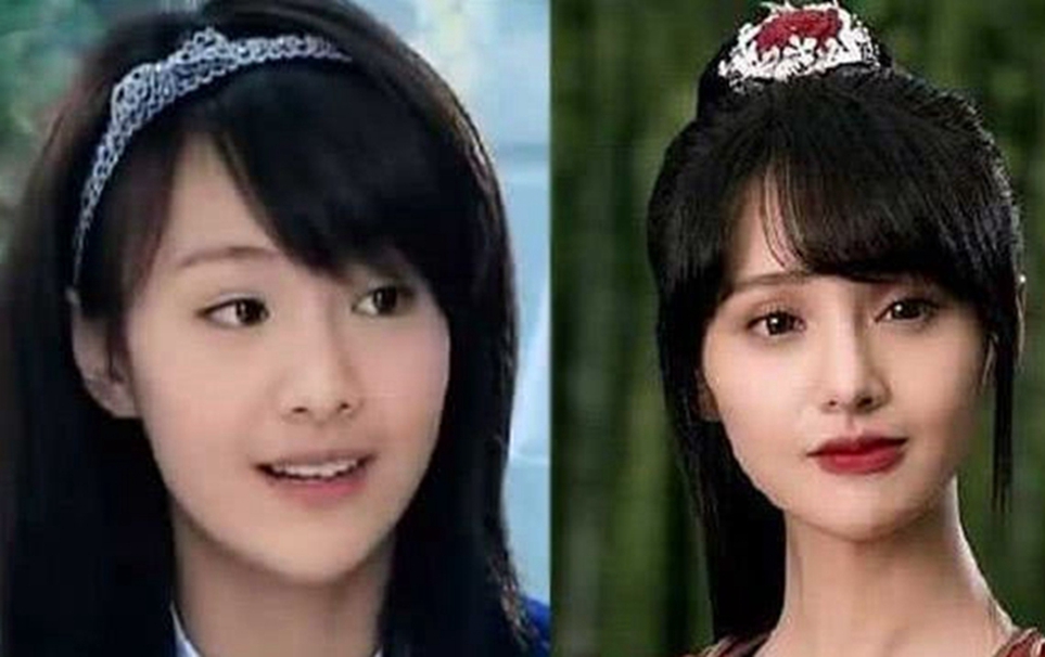 整容|整容过度的九位女星,整好了那叫换头,整不好堪称毁容!