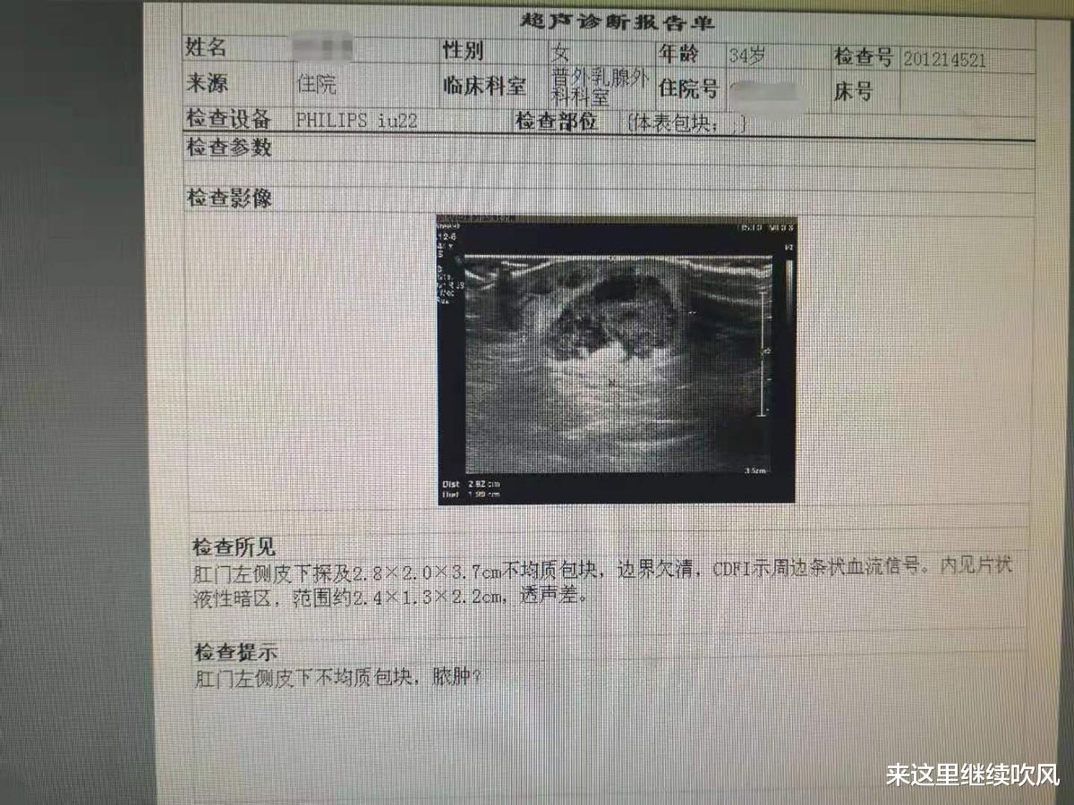 医生|肛门附近长“痘”,女子拒绝就医!医生:小心痛不欲生