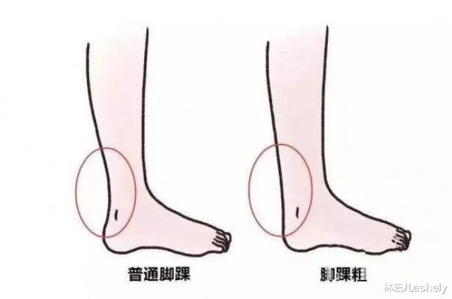 央视|杨幂脚踝17.2cm，李沁脚踝19.5cm，这么细的脚踝是真实存在的吗？