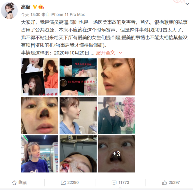 医美|女星高溜自曝隆鼻失败引发鼻子坏死，曾多次想过自杀