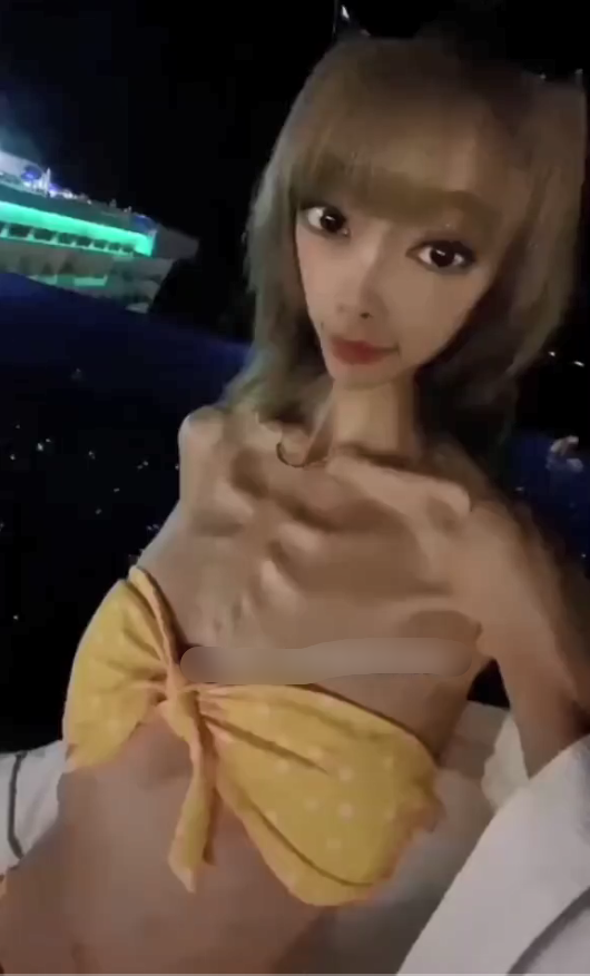 丝芙兰 女网红过度减肥瘦成皮包骨，穿泳衣秀身材胸前肋骨清晰可见