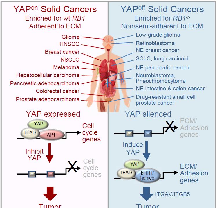 Cancer Cell:所有癌症可简单分为两大类,根据是否表达YAP蛋白