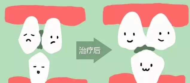 牙齿|想吃点肉都塞牙，咋整？