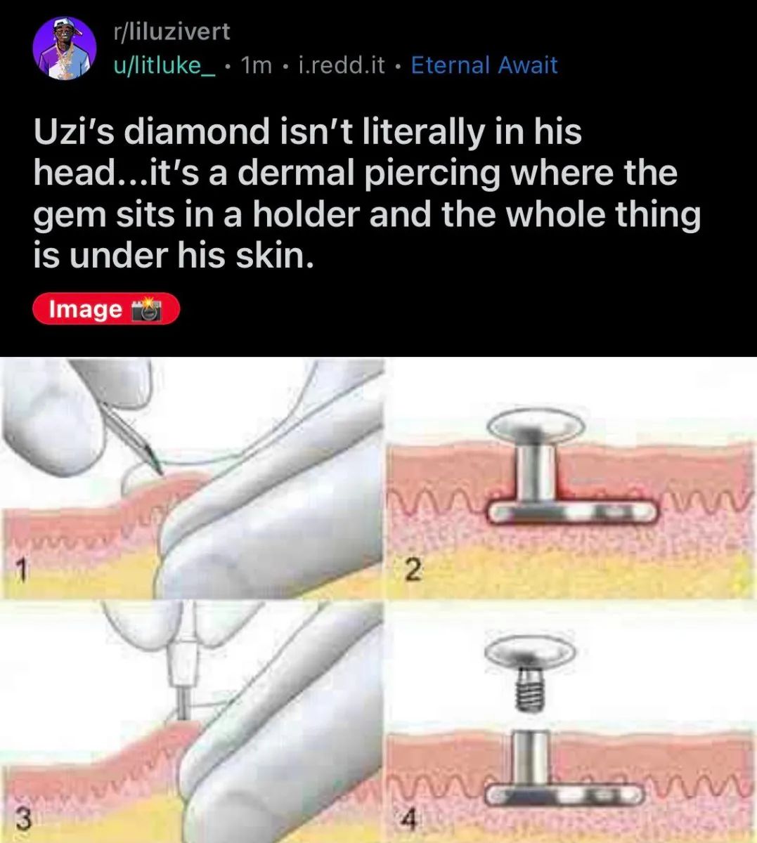 二郎神|美国说唱歌手在额头植入一颗1.5亿的粉钻，网友：这说唱界“二郎神”？