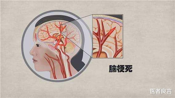 医者良言 盐吃多了对身体有哪些不好？