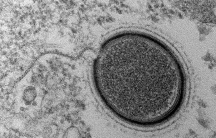 二氧化碳 青藏高原出现史前病毒，它们来自1.5万年前，会威胁人类吗？