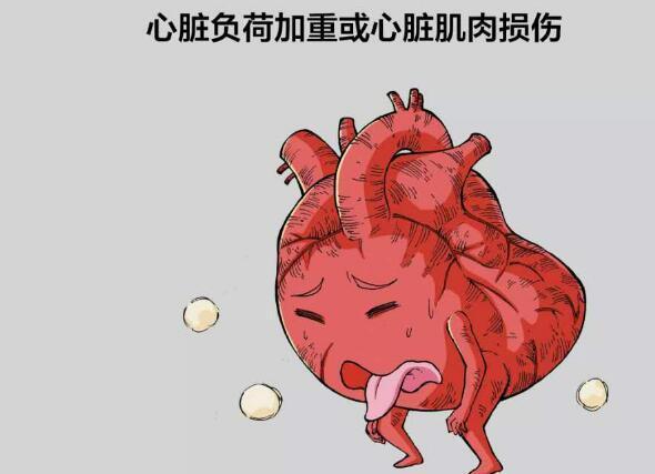 心力衰竭|心力衰竭有4次预防机会，注意3个早期症状，还请做好预防！