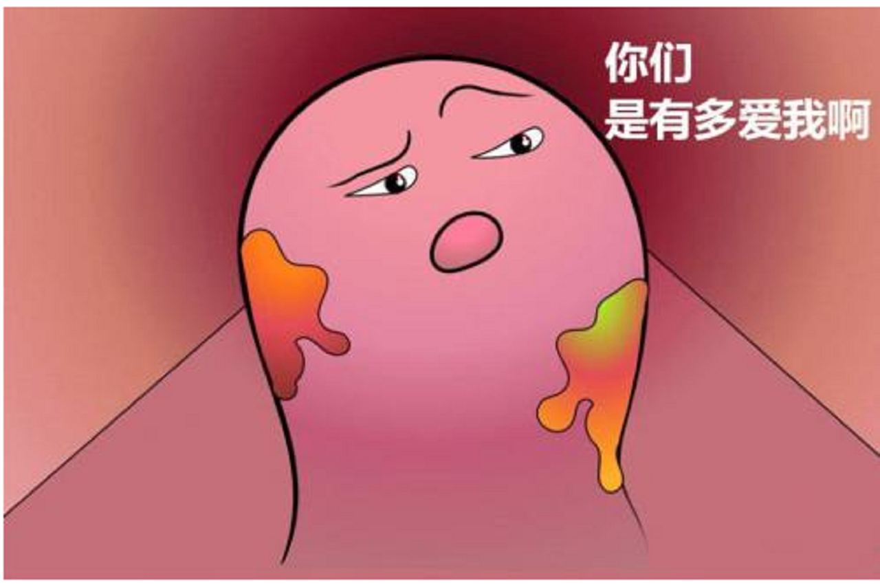 谢朋飞说育儿|痔疮肉球多次发作需要斩草除根吗？医生：这样做效果最好。