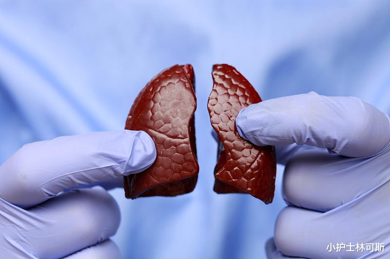 牛奶|肺小结节是什么?身体出现肺小结节该如何治疗?