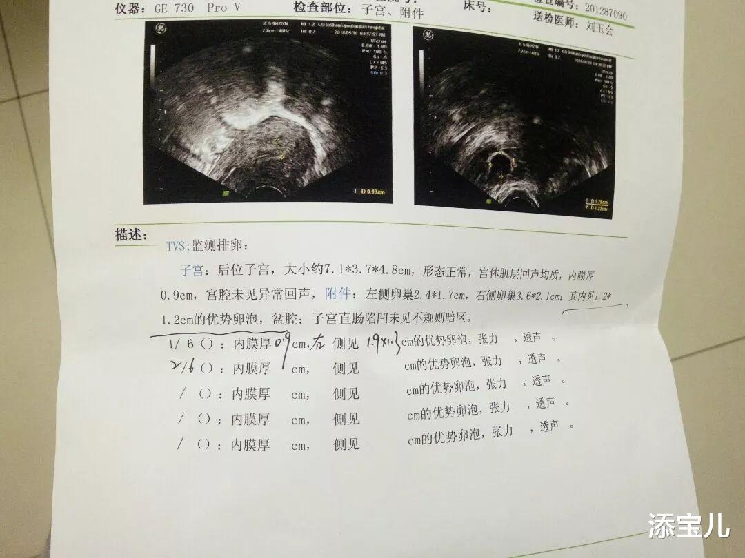 添宝儿|试管婴儿过程中监测卵泡有多关键?