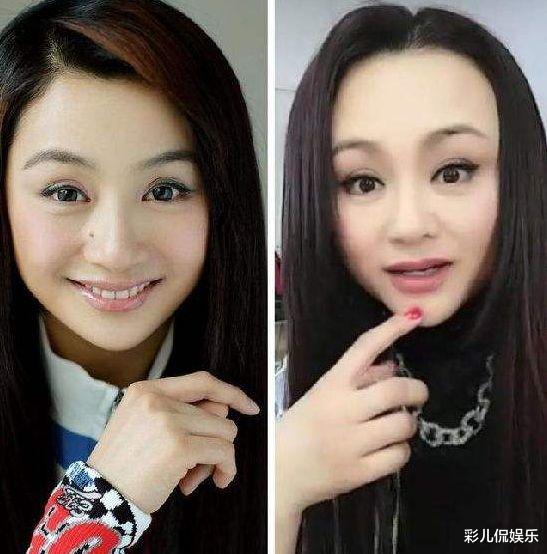 整容|“又美又丑”的误会，她们明明长得纯天然，却像极了整容脸！