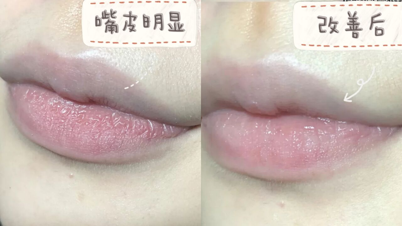 护发素 孕妇唇膏全盘点！用错小心得唇炎，小蓝罐凡士林上孕妇黑榜！慎买