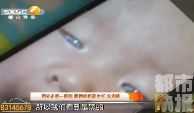 陕西都市快报 陕西男子发现孩子眼睛有问题，送医检查竟发现......