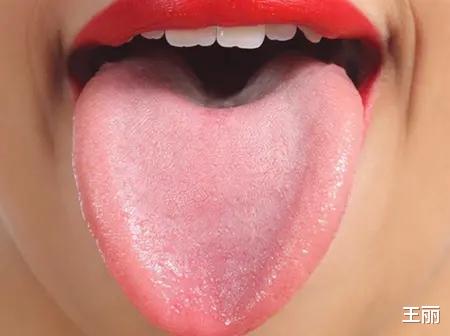 |中医：小小舌头，大有乾坤；认识几种常见的经典舌头，带详细图解