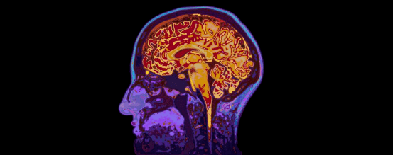 同基声|心理压力可能会导致HIV患者出现脑部炎症