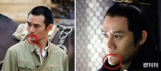 整形|明星的N种“假下巴”，尖到戳死人，翘成老巫婆，一个比一个怪异