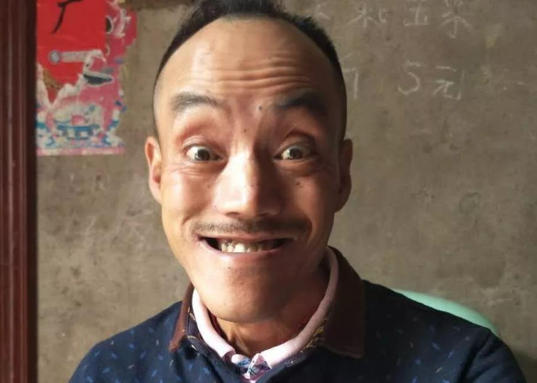 |网红“光头强”风光不再，小20岁娇妻离他而去，豪车豪宅终成空