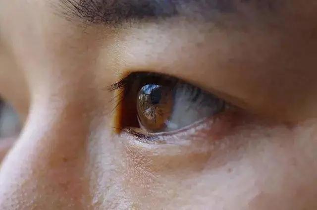 小手氷凉|气为阳，血为阴！你的气血足不足？从这 5 个部位就能看出来