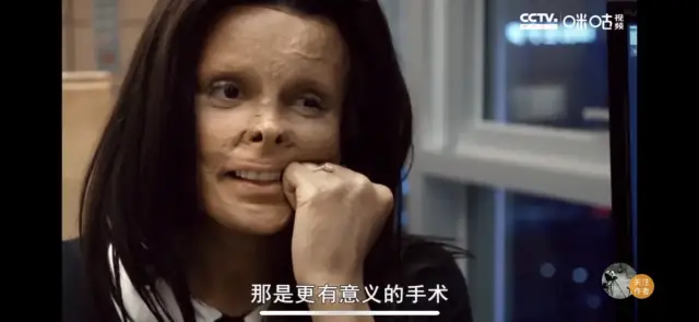 金针菇|二美：整形，一个美丽的“陷阱”