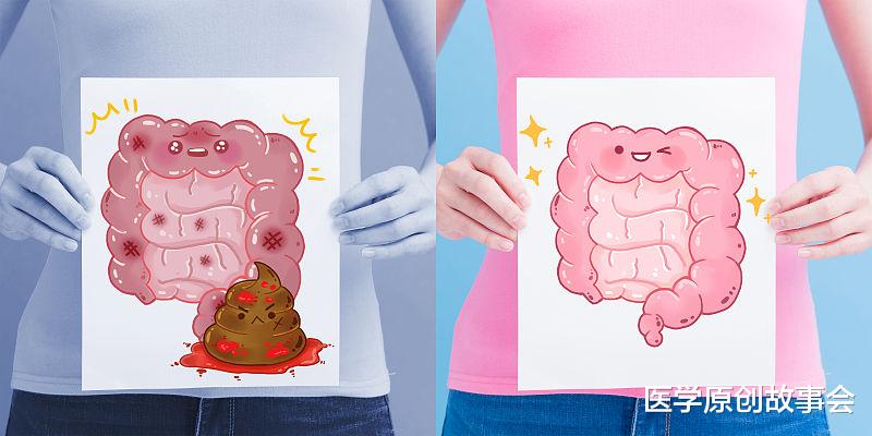 医学原创故事会 直肠癌：从确诊到死亡不足一年，大便出现三种特征，或是它的信号