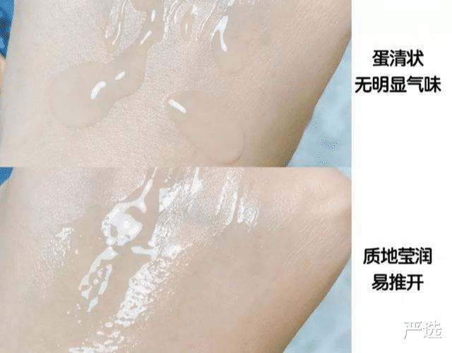 严选|连续打了6年“美白针”的女人，如今怎么样了？网友：难以置信