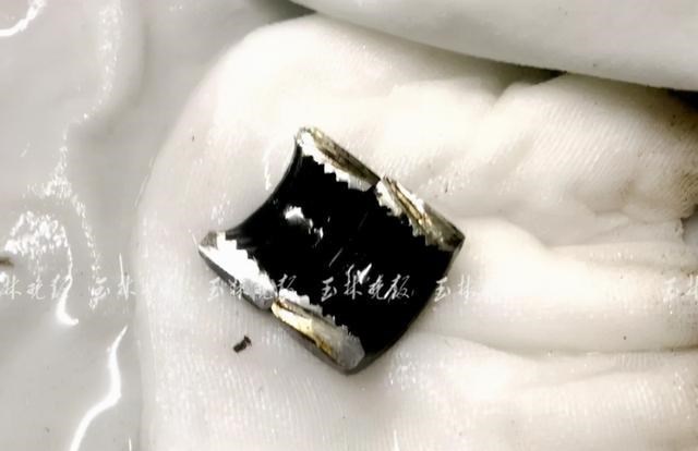 阳光语言矫正说|男子将金属环套进下体险被切除：盲目寻求刺激会导致严重后果