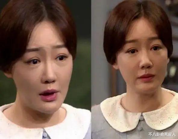 郝蕾|女星步入中年的尴尬，眼凸，法令纹，发福，脸僵，女神颜值不再