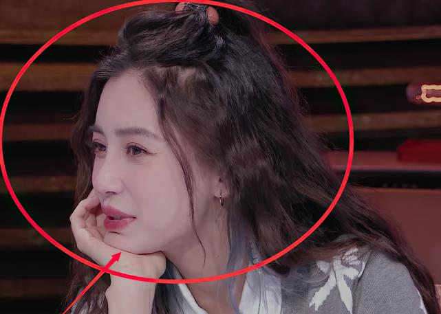 整容|baby伸手挤压到下巴，意识过来立马松手，随后的下巴形状看呆粉丝