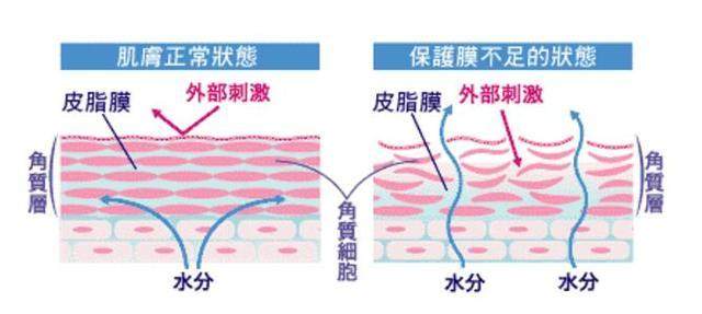 皮肤干燥 洗完脸皮肤干燥紧绷起皮怎么办？做对这三件事，重新找回水嫩肌！