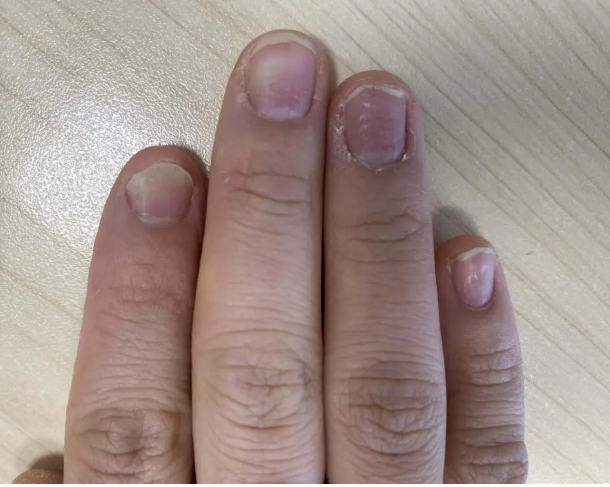 刘海|割阴、挑筋、断骨、割胃，那些为了美不要命的女人到底有多可怕