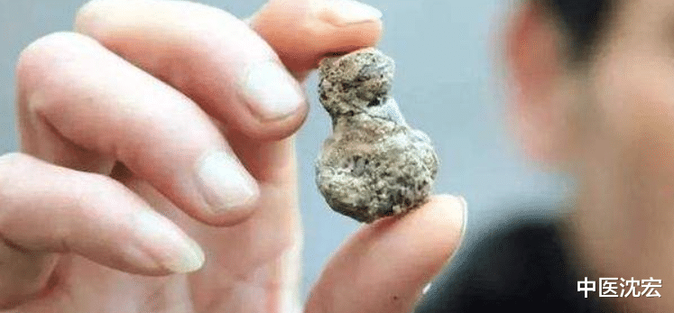 中药|结石？送你三味中药，一个排石，一个化石，一个清热