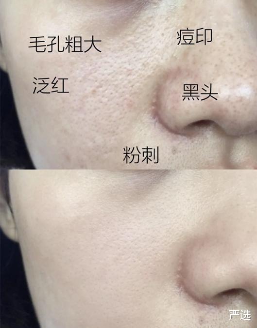 景甜|“人间富贵花”景甜，分享护肤小技巧，网友：难怪肌肤那么白嫩