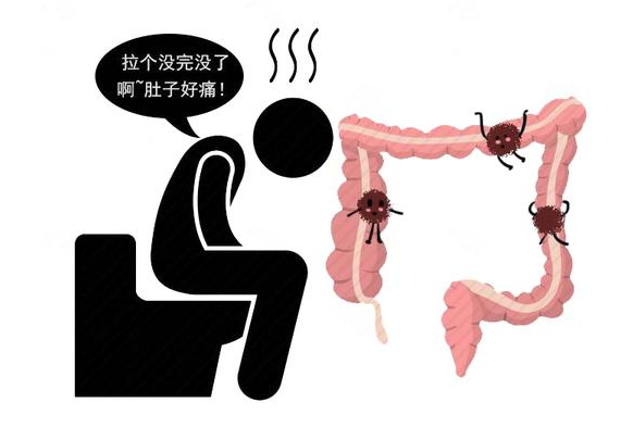 肠癌|“屁”大点小事和癌症也挂钩？医生：放屁有3种迹象，当心肠癌！