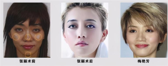 梅艳芳|她整容十几次成“梅艳芳”，金星见到她瞠目结舌，刘德华泪奔