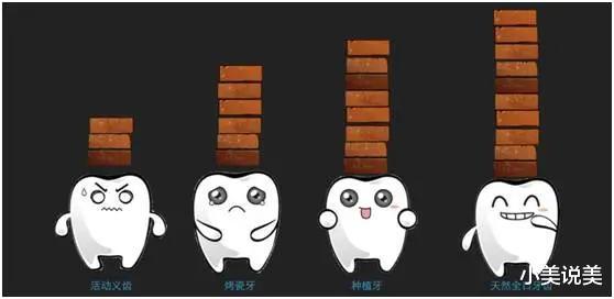 小美说美 种植牙有哪些优点？缺牙太多能种牙吗？