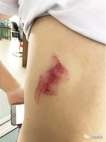 狮子 野外被动物咬？除了等死，你要了解这些求生技能