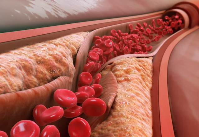 空心菜|吃一口等于6斤苹果，内科主任直言：若你常吃，血管一通到底